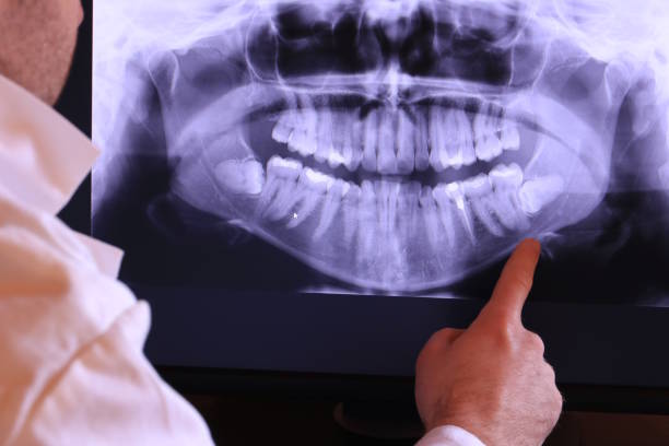 Best Broken Tooth Emergency  in Bondurant, IA